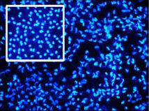 Mikroskopische Abbildung des Koi-Herpesvirus in Blaufärbung