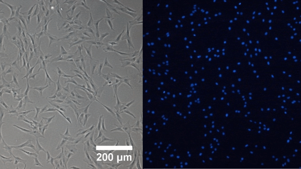 Microscopic pictures (fluorescense and brigth field) of a fish cell line